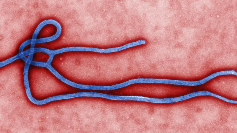 Colourised electron micrograph of an Ebola virus particle